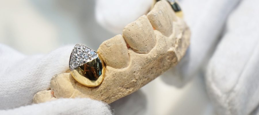 tooth jewellery